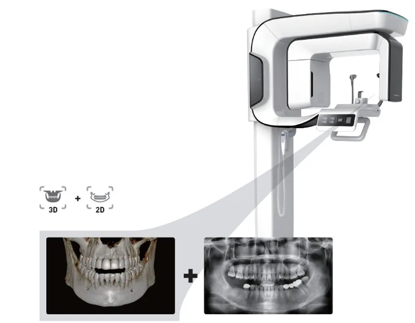 Vatech PaX-i3D Smart — Ansicht 3